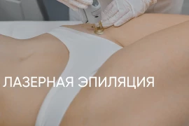 Лазерная эпиляция